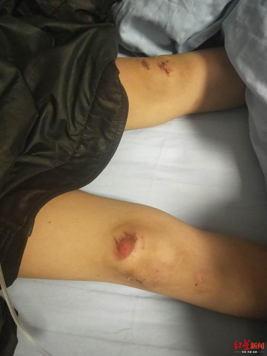 乡镇党政办主任驾奔驰撞上3名小孩 致1死2伤