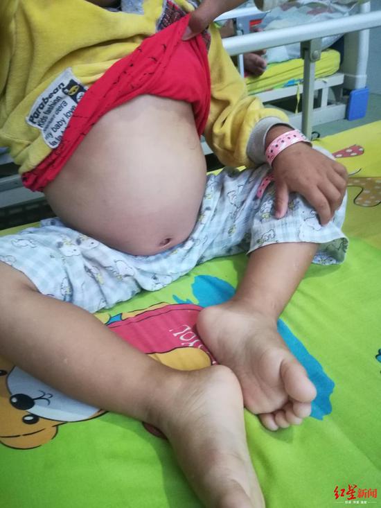 小俊熙的肚子鼓鼓的