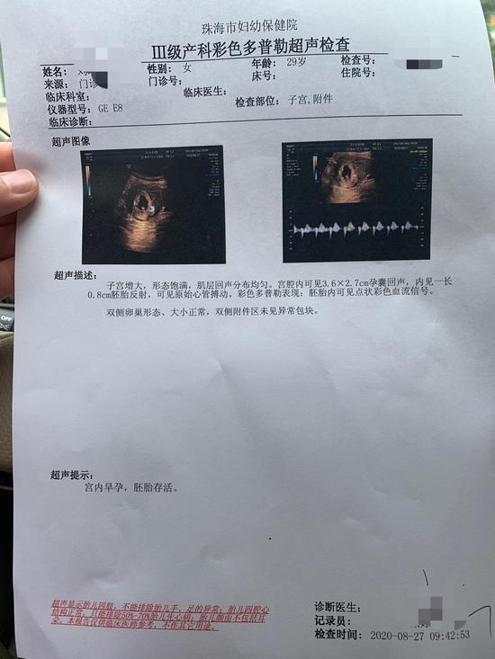 "优孕行"提供的代妈在合作医院"珠海市妇幼保健院"超声检查单.