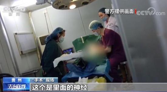贵州一医院未缝伤口让病人取钱 手术台上又让刷