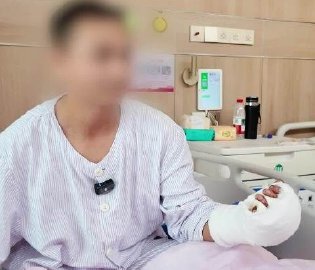 男子断四根手指后全部成活