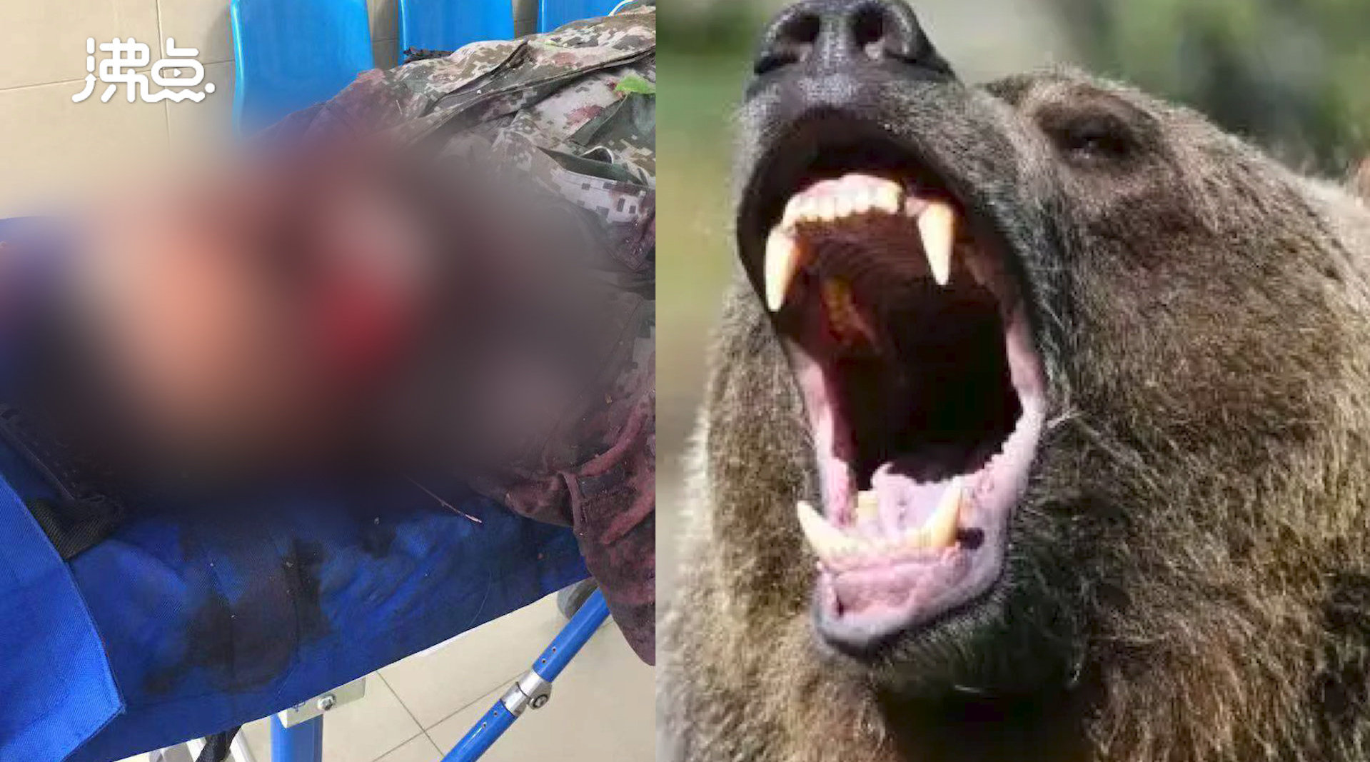 黑龙江一男子山上采野菜时遭黑熊袭击家属受伤严重正转运哈尔滨