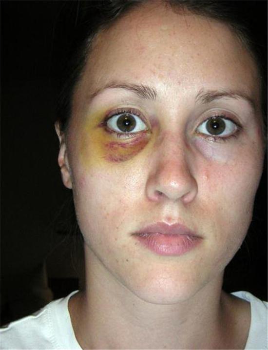 特朗普秘书被指家暴两任妻子辞职 白宫称未施压