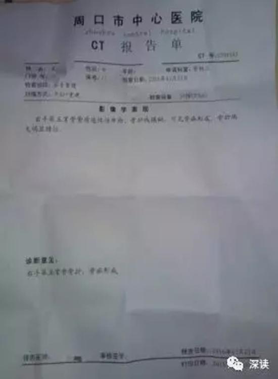 周口市中心医院对吴某某骨折ct报告单