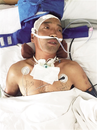 男子被撞重伤失语 警方寻找伤者家属