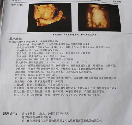 22日,记者从许先生提供的四维超声报告单上看到,报告单显示有腹腔内