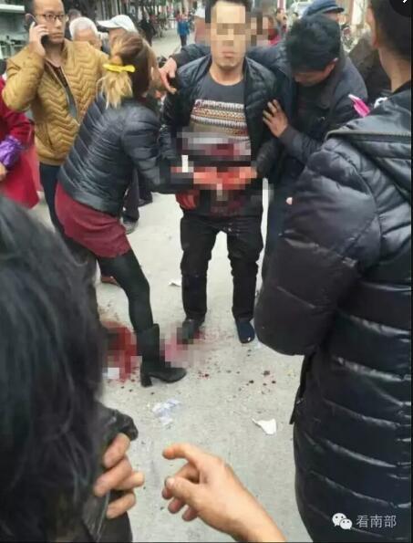 南充男子当街捅伤情敌 疑因感情钱财纠葛引发