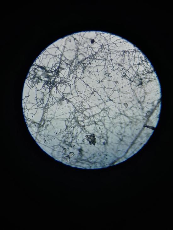显微镜下看到的菌丝显微镜下观察菌丝和菌霜在研究过程中,还用显微镜
