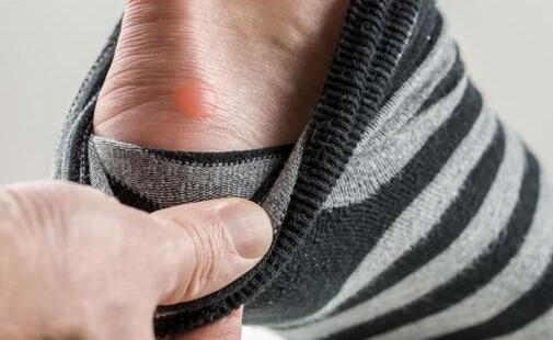 跑步如何预防水泡 5个知识告别痛苦