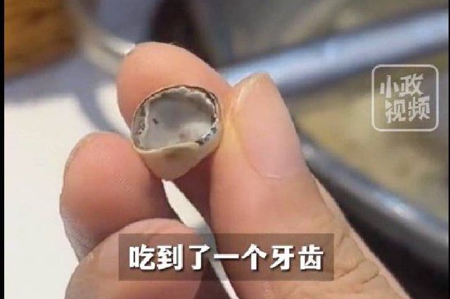 吃火鍋時吃出牙齒？回復：系顧客本人脫落的金屬烤瓷牙冠套