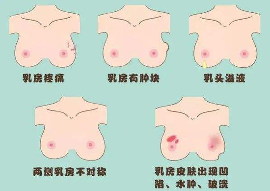 乳腺癌的皮肤凹陷图片图片