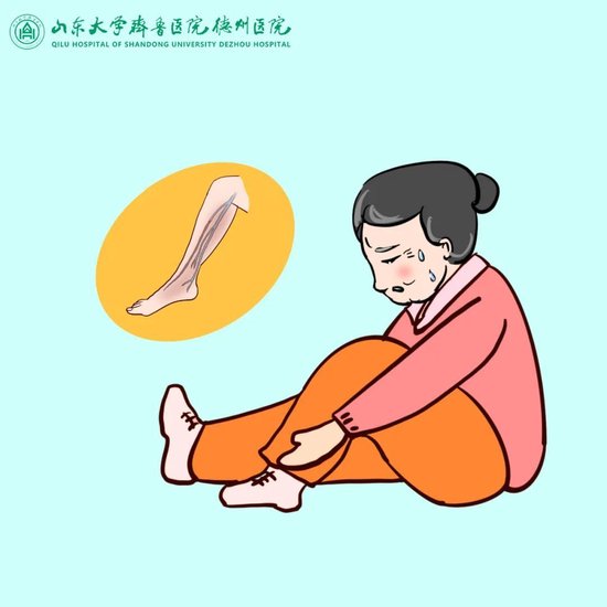 什么腿肿也可能致命警惕下肢深静脉血栓
