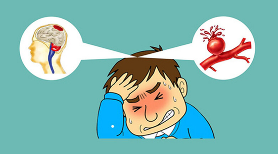 脑血管"鼓包" 变"炸弹"|德州市第二人民医院:微创介入多学科合作化身"