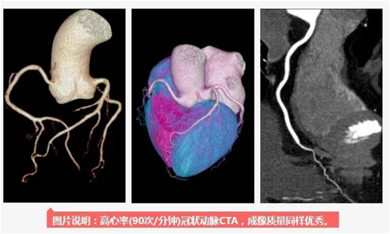 德州市中医院每月21日为冠脉ct惠民日当天检查费用7折欢迎咨询预约