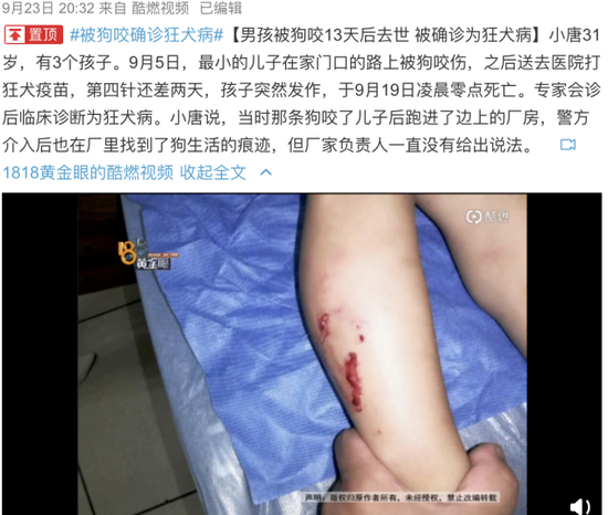 男孩被狗咬13天后去世,责任该如何划分?