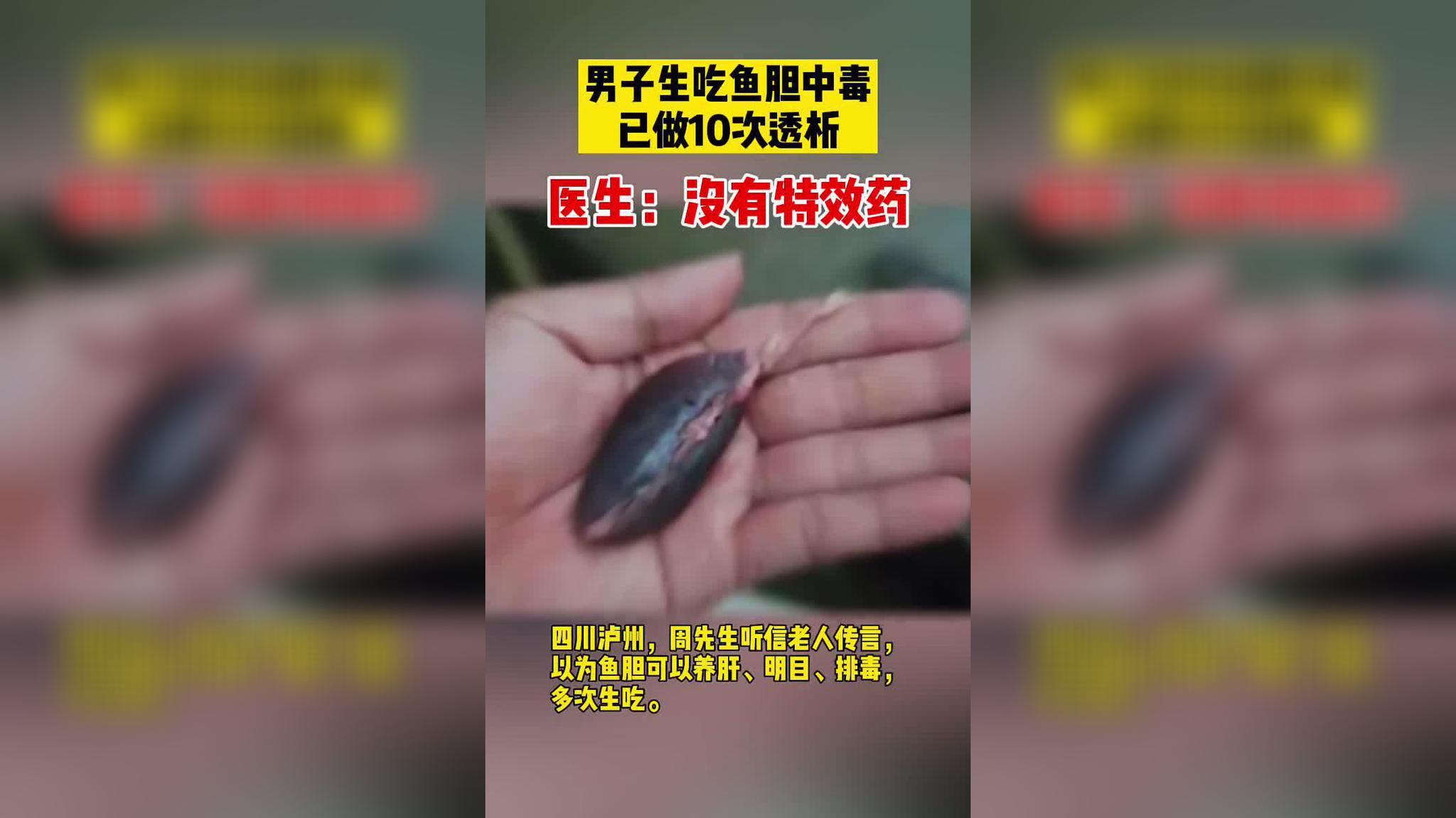 男子生吃鱼胆中毒已做10次透析 医生:鱼胆里面含的都是毒素