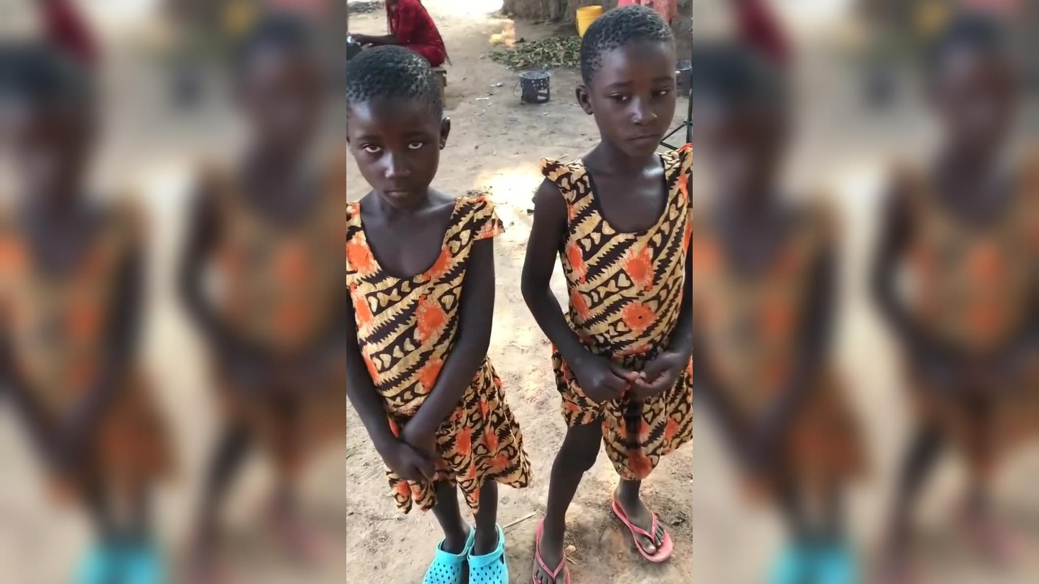 非洲人双胞胎是分不清男孩还是女孩