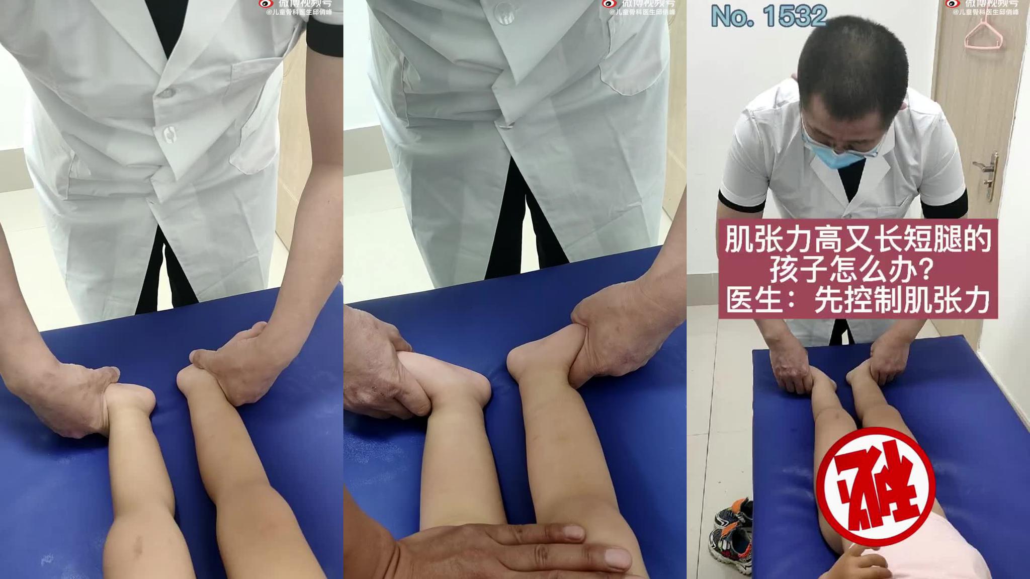 肌张力高的宝宝,医生建议多做这四个动作!