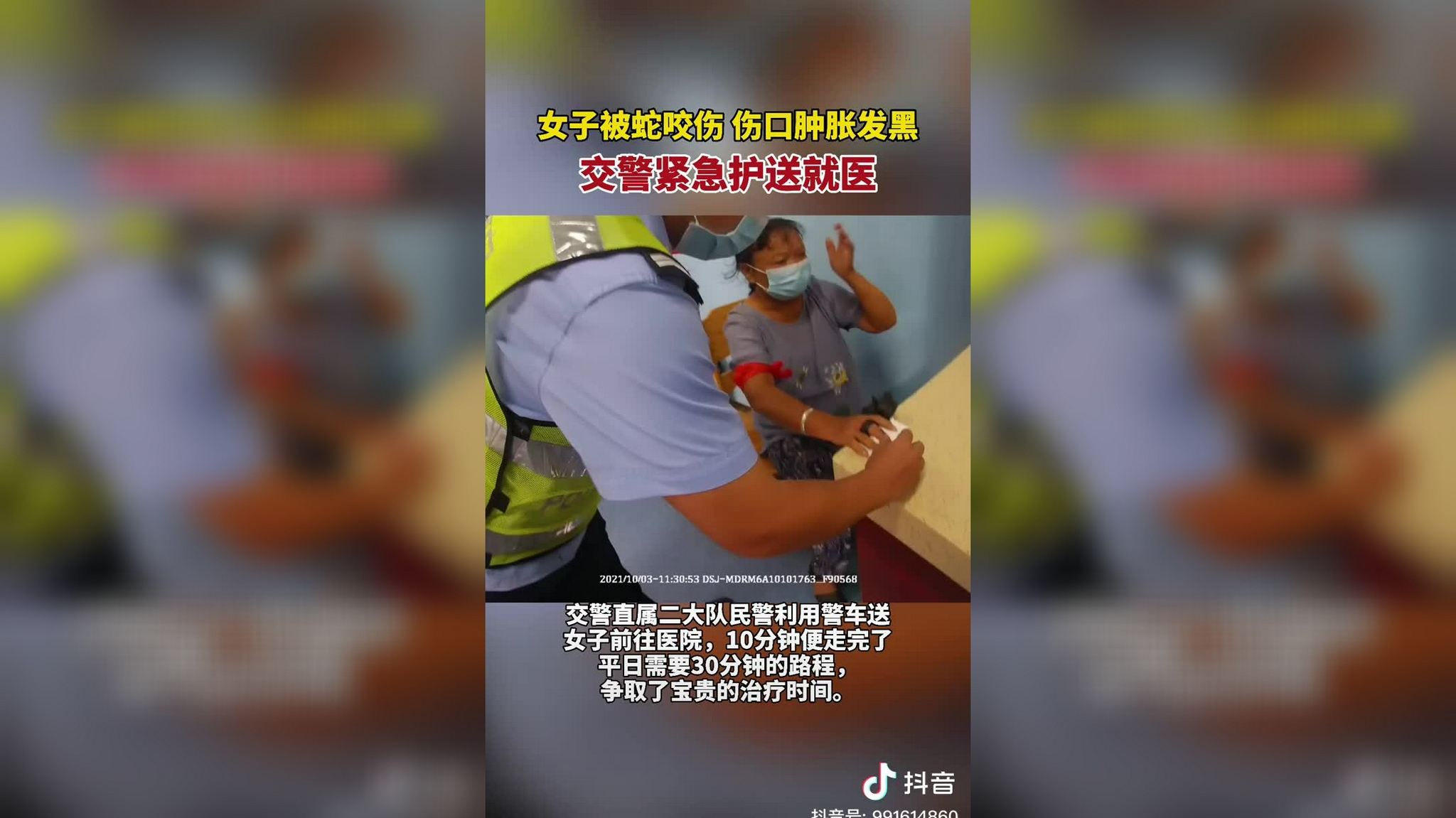 女子被蛇咬伤,伤口肿胀发黑,交警紧急护送就医