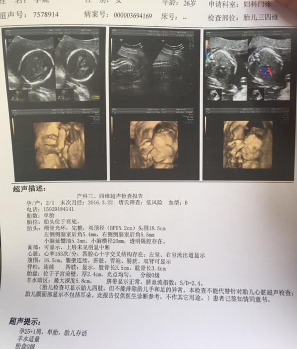 跟大家分享四维如何得知男宝 并分享下怀男宝症状 逢接必中