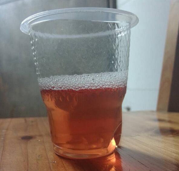 所以,奉劝大家,每天早上仔细观察尿液和粪便,然后调整生活,饮食习惯