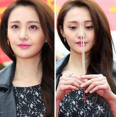 郑爽整容取出假体被曝颜值逆天, 你见过吗?