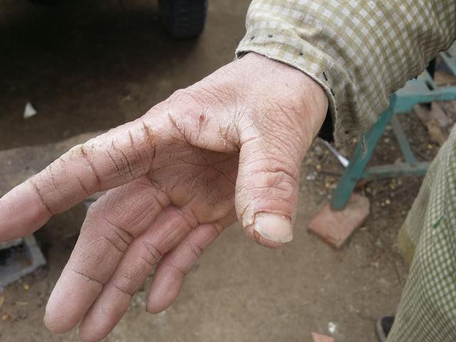 有一种手叫做"母亲的手",小时候喜欢让娘抓痒痒