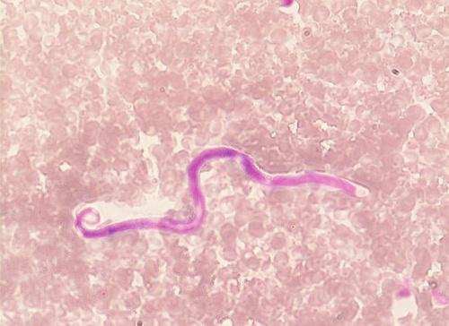 microsoft|寄生虫|蛲虫_新浪新闻