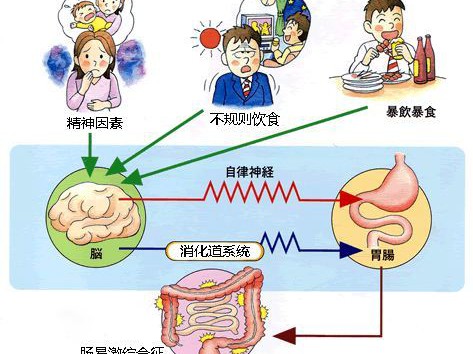 益生菌是最好的药(八):益生菌与肠易激综合症