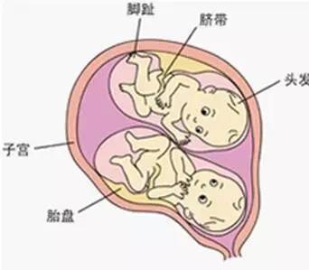 神奇的过程,一模一样的双胞胎是这样产生的|双胞胎|发育|受精卵_新浪