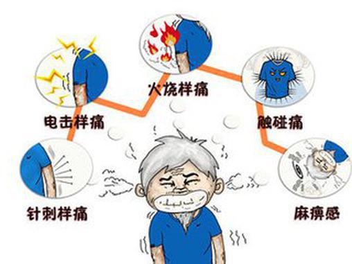 关于关于疼痛的分级你知道多少？|疼痛的|疼痛|剧痛_新浪新闻