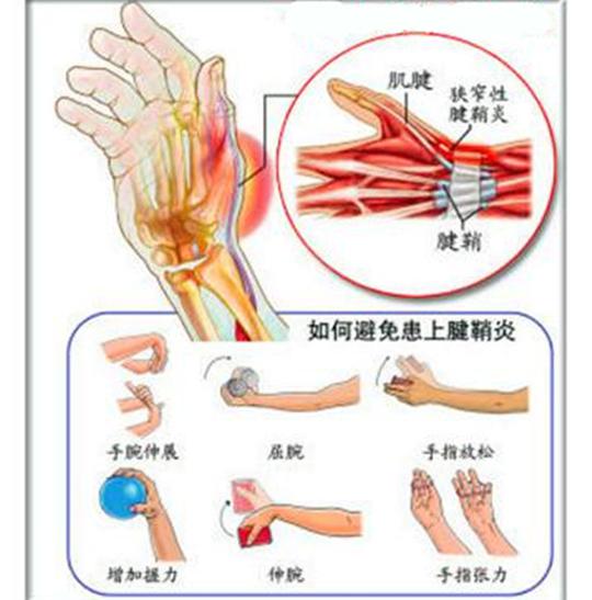 腱鞘炎腱鞘囊肿疼痛症状该如何治疗?