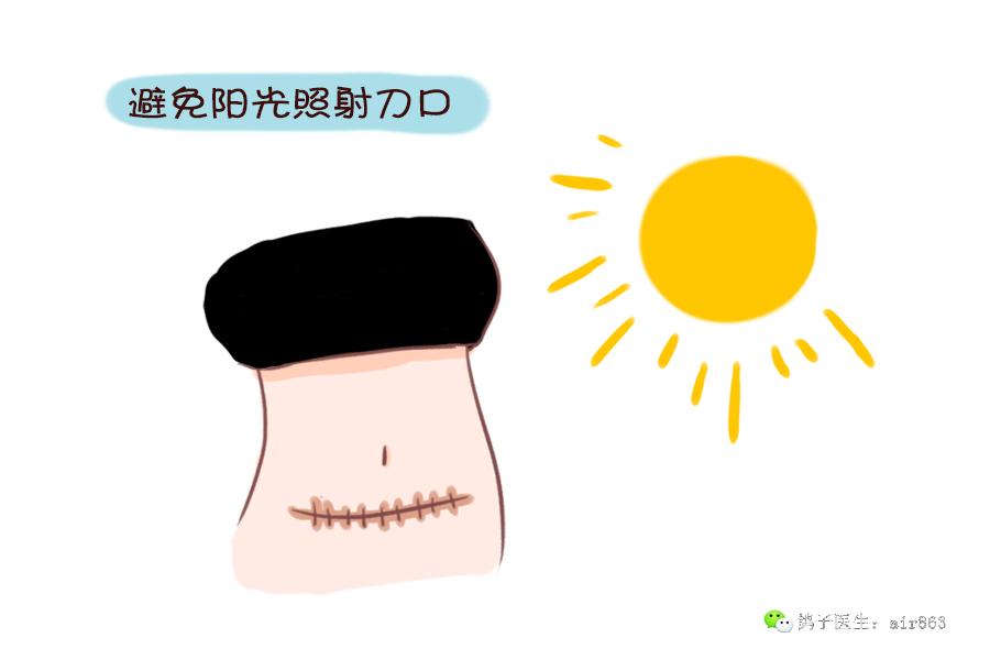 如何护理剖腹产疤痕,防止增生|剖腹产|疤痕|增生_新浪新闻