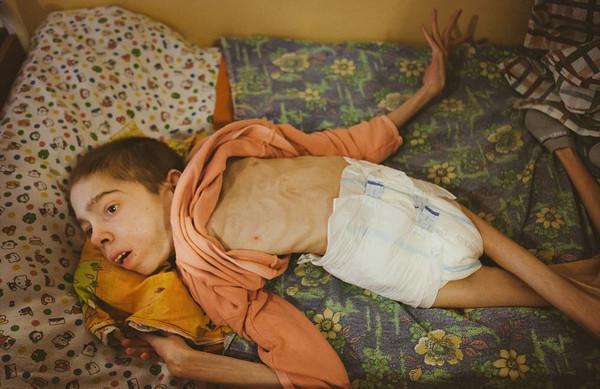 白俄罗斯黑暗孤儿院被曝光,激起民愤,院长被解雇