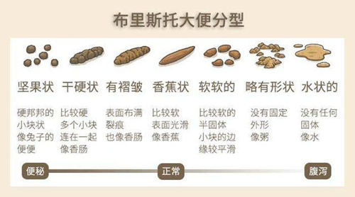 大便粘马桶,到底意味着什么?
