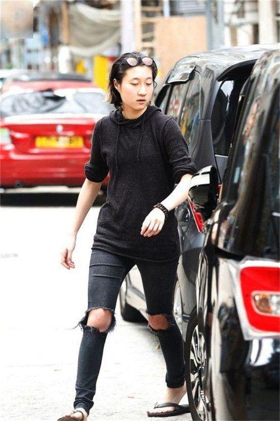 小龙女出院手臂上的伤痕,是遗传还是教育问题?