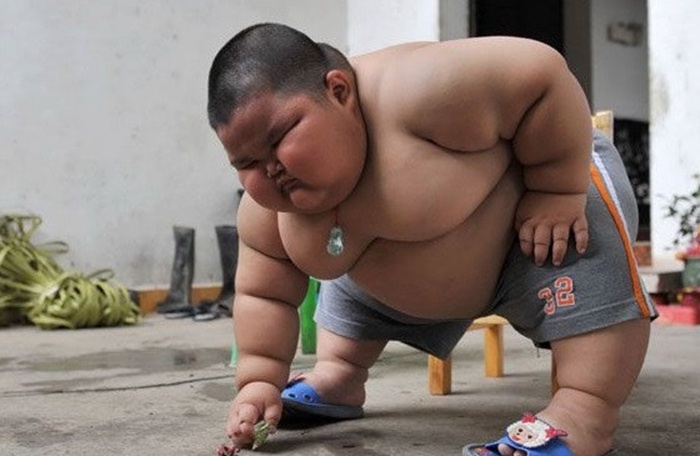 三岁男孩体重达120斤,眼睛眯成缝,智商超同龄儿童