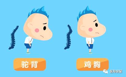缺钙致使脊柱的肌腱松弛,宝宝可出现驼背,鸡胸等表现;4,骨骼畸形:3