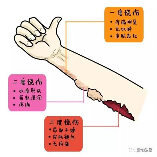 收藏这6种宝宝常见外伤急救法,关键时刻能救命!_手机新浪网