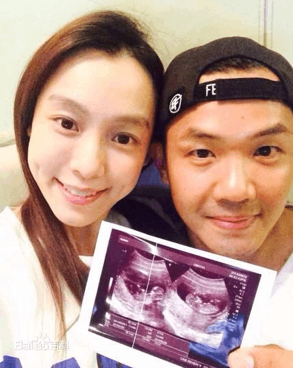 范玮琪38岁试管成功 谁料一怀就是双胞胎