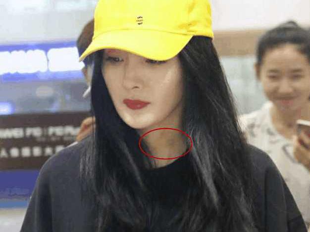 杨幂脖子现草莓印被传播, 原来她因电影感冒到失声
