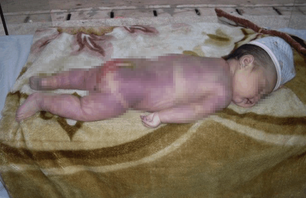 女童被亲妈打屁股致死孩子不听话打屁股的危害