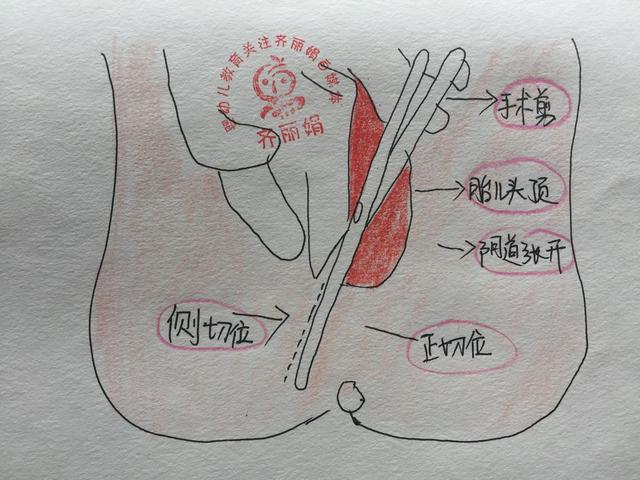 听老一辈人说能顺产尽量顺产,不仅自己身体恢复快,对宝宝健康也有很大
