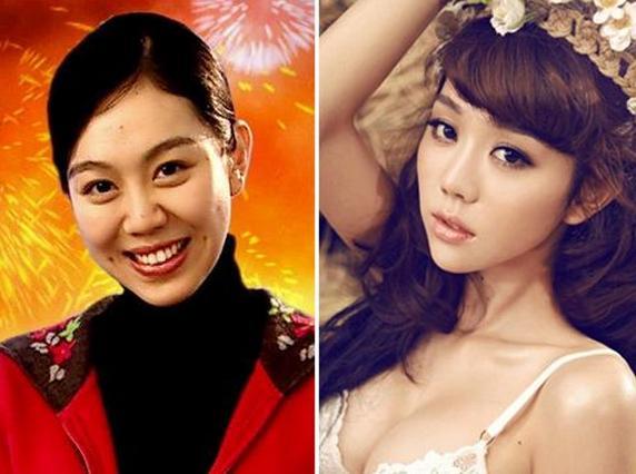 她是朱雨辰前女友,宋丹丹干女儿,整容路上越走越远