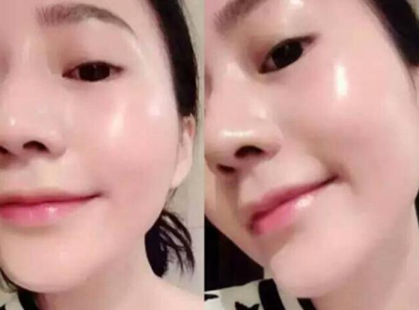 面膜多久做一次好?两天一周?大多都做错了才皮肤差