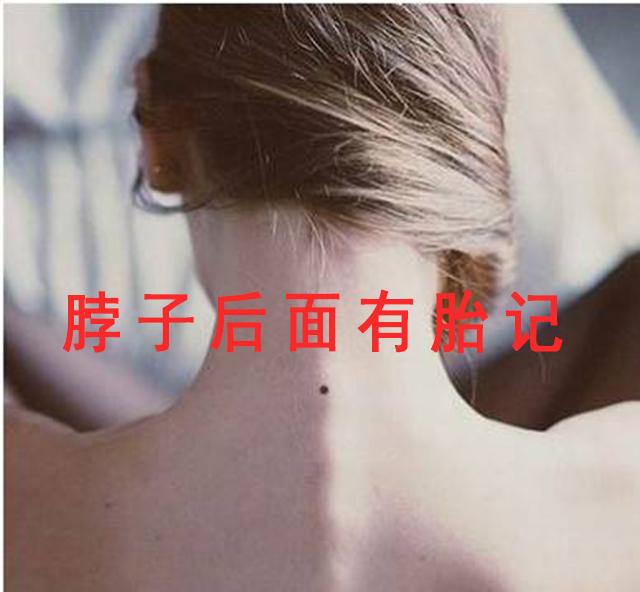 胎记长在这三个位置注定一生不凡