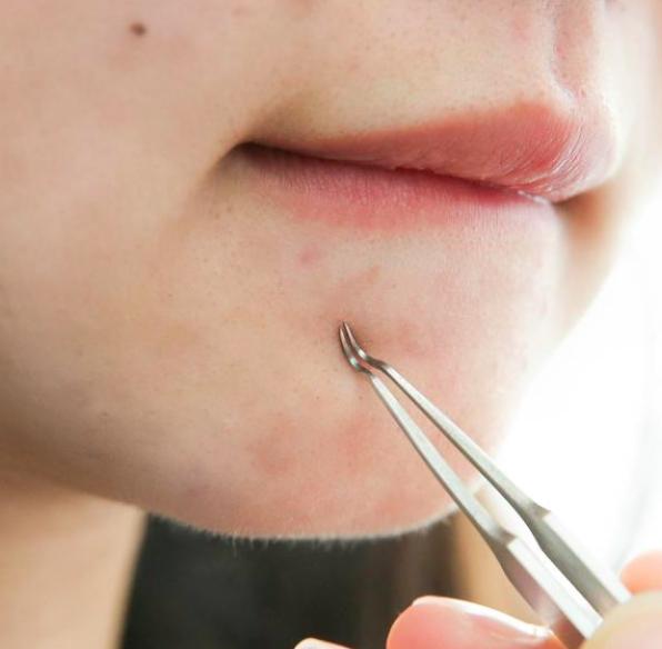 眼角为什么会长脂肪粒?因为你做错了这几件事情