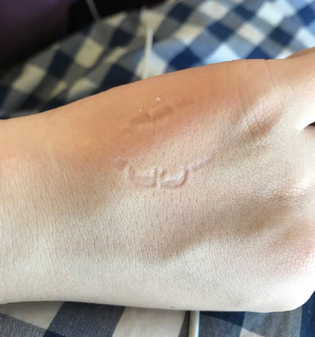 被老公家暴还是爱的咬咬?福原爱晒照直呼心痛!