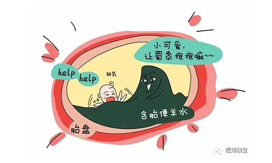 分娩时的危急情况:羊水粪染 孕妈你做好预防了吗?