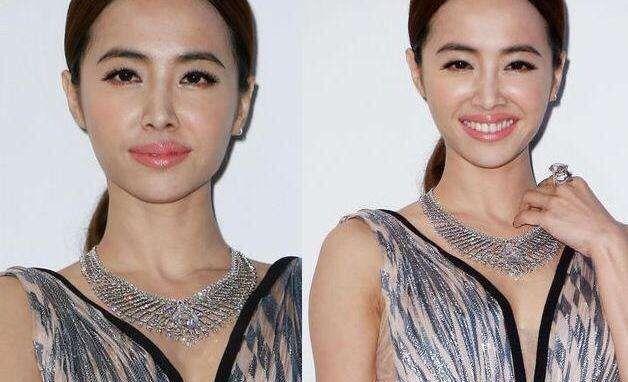 不敢大笑硅胶会掉,表情不自然,盘点脸部越来越僵硬的几位女星